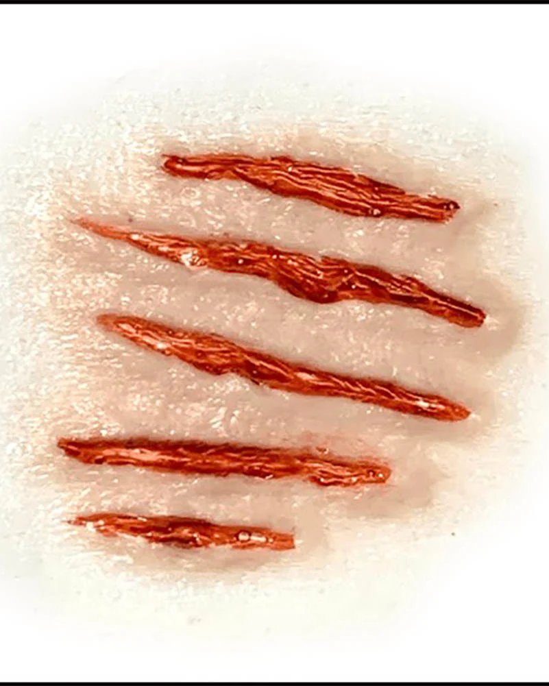 Attacked FX Appliance Transfer Prosthetic Wound - Image 3