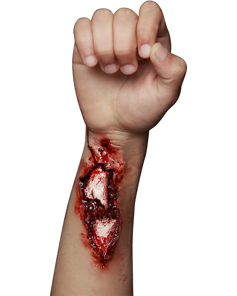 Broken Arm FX Appliance Transfer Prosthetic Wound