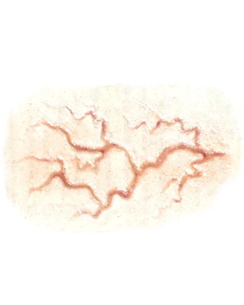 Large Veins FX Appliance Transfer Prosthetic - Image 2