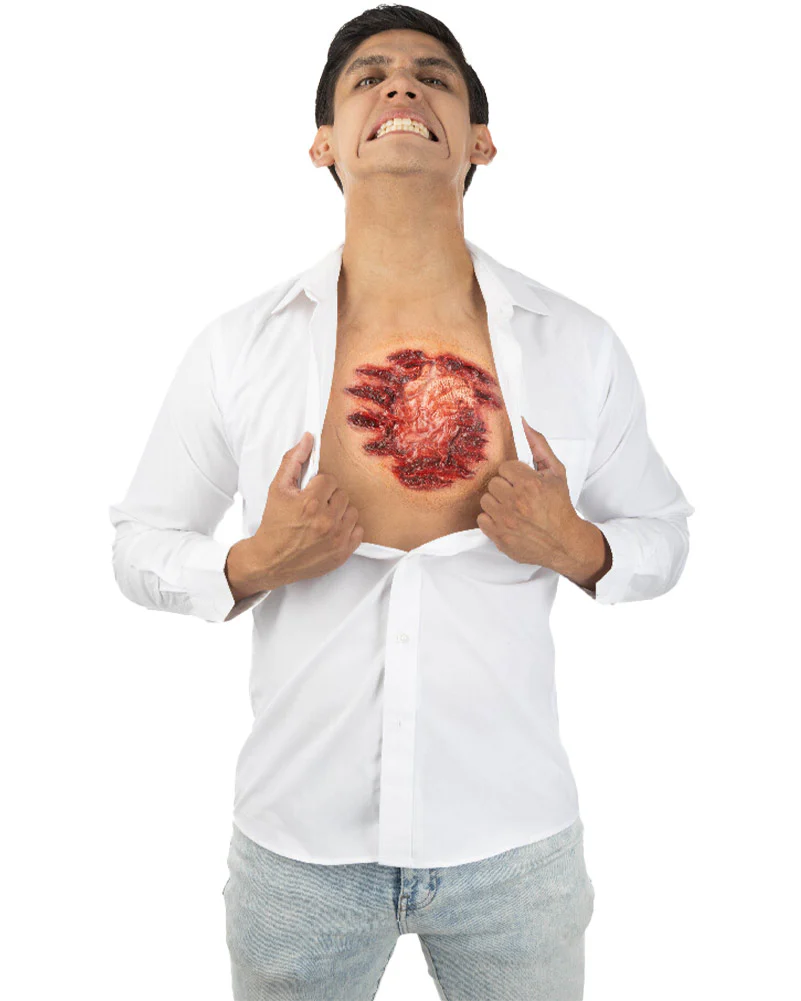 Open Chest FX Appliance Transfer Prosthetic Wound